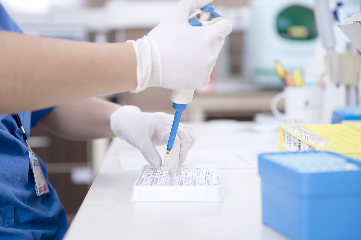 Unifor realizará teste de novo coronavírus com resultados em até 48h
